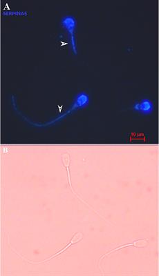 Relationship of field and in vitro fertility of dairy bulls with sperm parameters, including DAG1 and SERPINA5 proteins